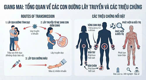 Bị giang mai có quan hệ được không và các giai đoạn nhiễm bệnh